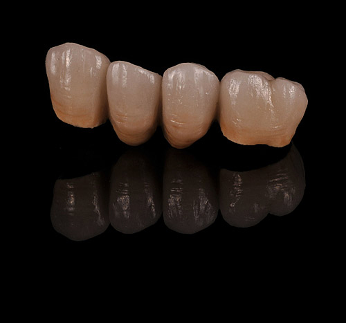 cover_metal_ceramica