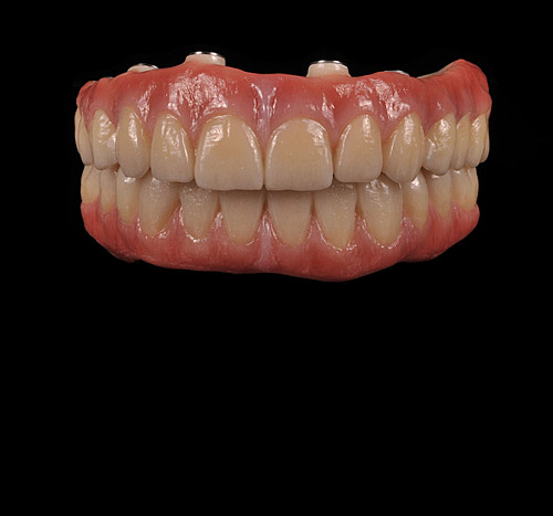 cover_zirconio-3_prettau